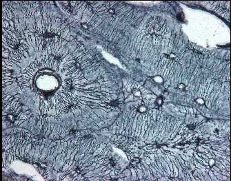 bone cells similitude