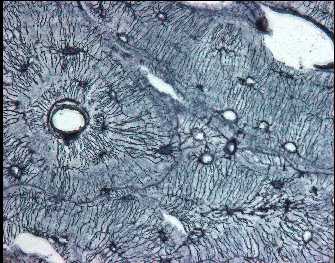 bone cells under microscope